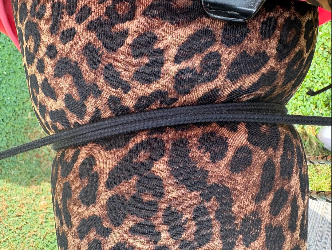Ingescheurde been – Lipödem-leggings mogen niet te strak zijn